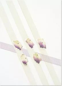 TOMMA ABTS Untitled 5-spots, 2009 Color sugar lift and spit bite aquatints with hard ground and flat bite etching. Image size: 18 x 12⅞; paper size: 23⅛ x 17⅝. Edition 20.